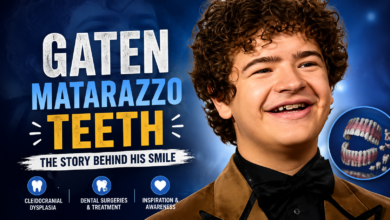 Gaten Matarazzo Teeth