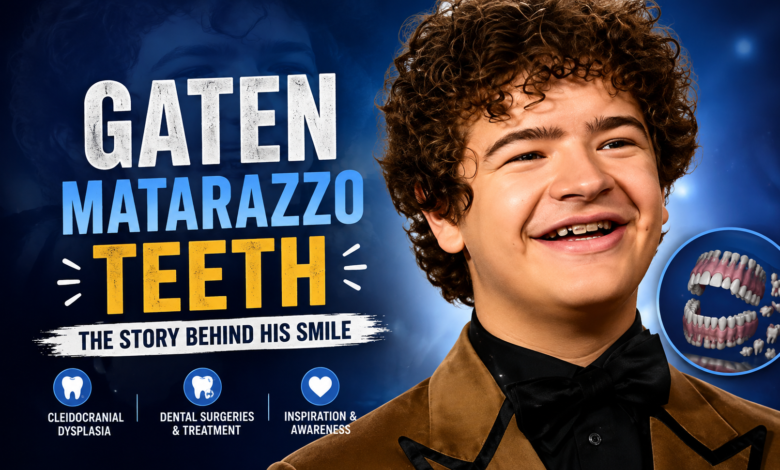 Gaten Matarazzo Teeth