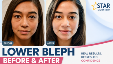 lower bleph before and after
