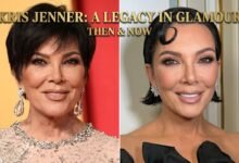 kris jenner before and after face lift