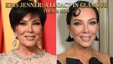kris jenner before and after face lift